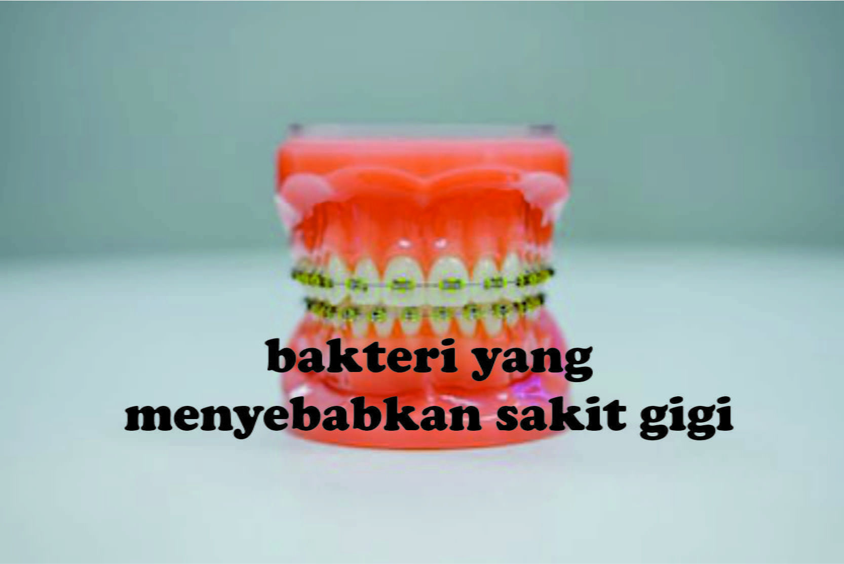 bakteri yang menyebabkan sakit gigi